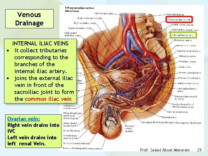 Venous Drainage INTERNAL ILIAC VEINS • It collect tributaries corresponding to the branches of