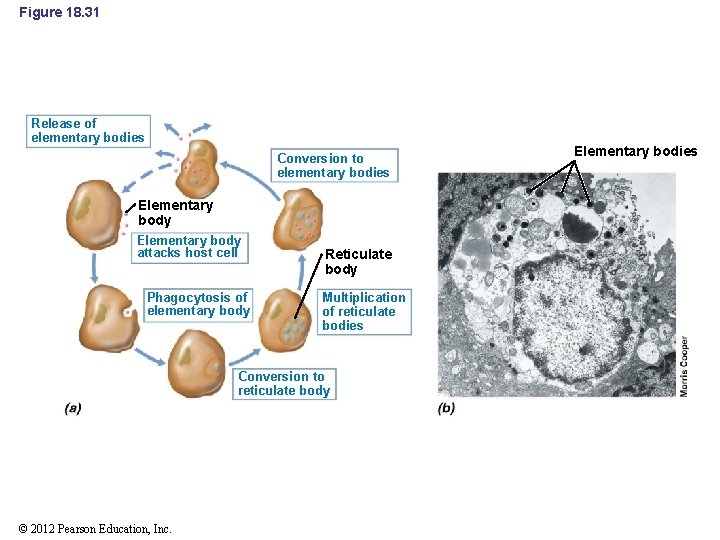 Figure 18. 31 Release of elementary bodies Conversion to elementary bodies Elementary body attacks