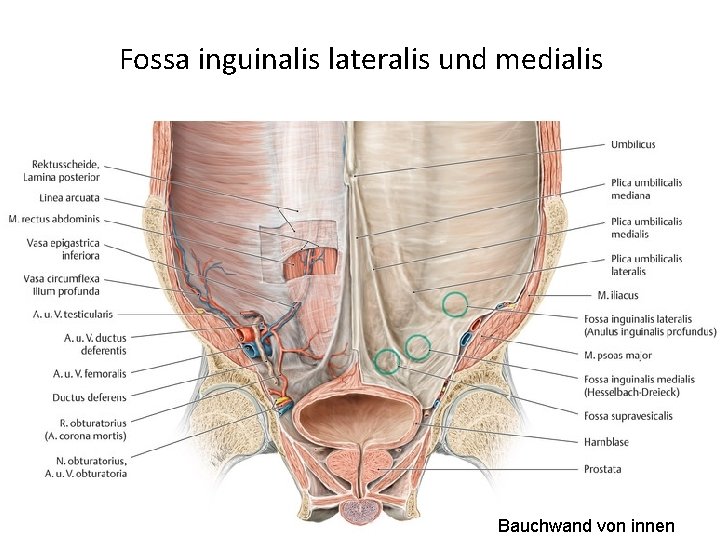 Fossa inguinalis lateralis und medialis Bauchwand von innen 