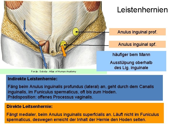 Leistenhernien Anulus inguinal prof. Anulus inguinal spf. häufiger bem Mann Forrás: Sobota - Atlas