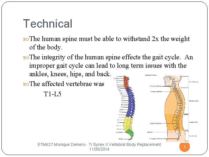 Technical The human spine must be able to withstand 2 x the weight of