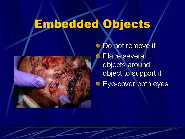 Embedded Objects Do not remove it Place several objects around object to support it