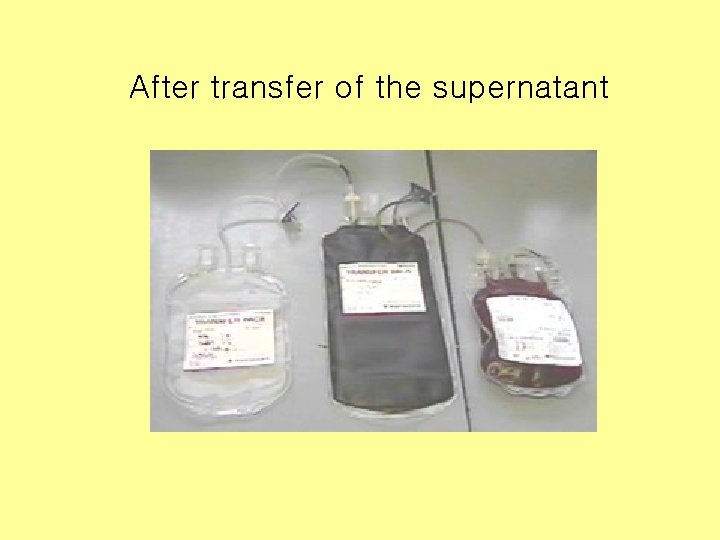 After transfer of the supernatant 