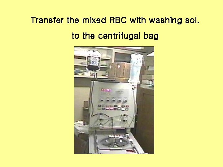 Transfer the mixed RBC with washing sol. to the centrifugal bag 