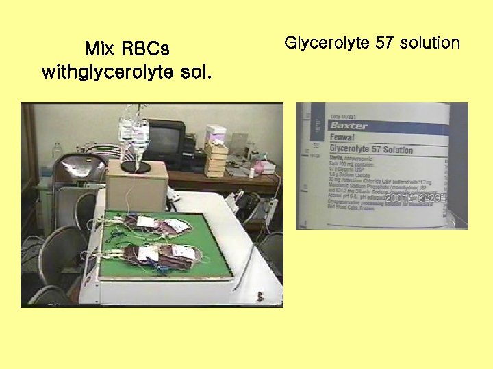 Mix RBCs withglycerolyte sol. Glycerolyte 57 solution 