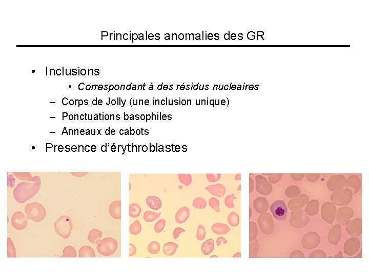 Principales anomalies des GR • Inclusions • Correspondant à des résidus nucleaires – Corps