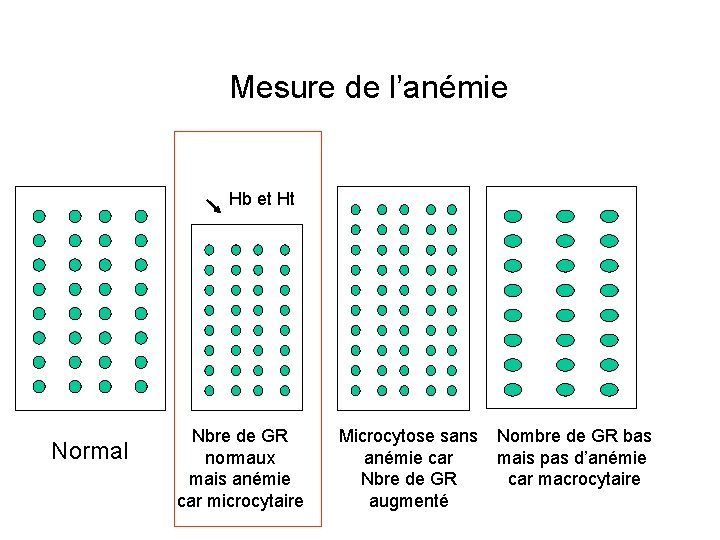 Mesure de l’anémie Hb et Ht Normal Nbre de GR normaux mais anémie car