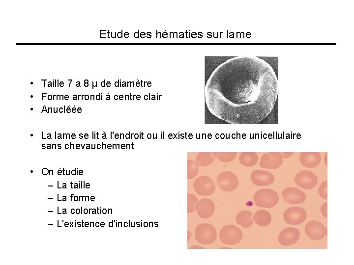 Etude des hématies sur lame • Taille 7 a 8 µ de diamètre •