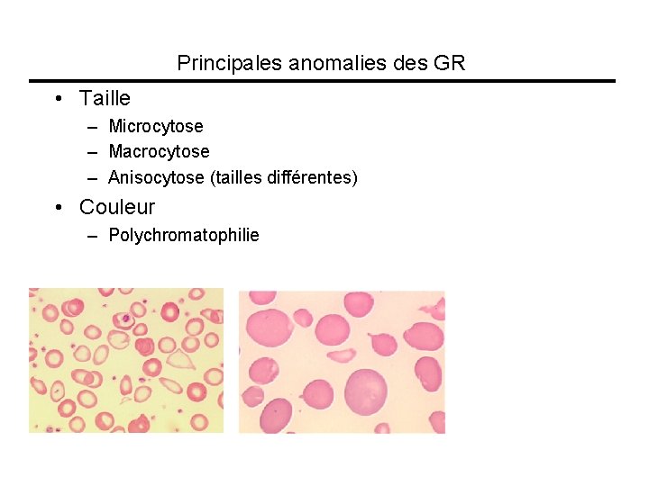 Principales anomalies des GR • Taille – Microcytose – Macrocytose – Anisocytose (tailles différentes)