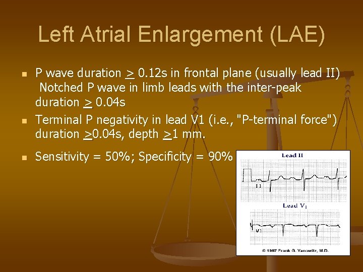 Left Atrial Enlargement (LAE) n n n P wave duration > 0. 12 s