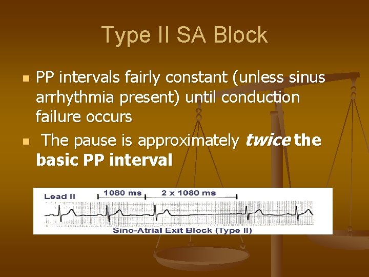 Type II SA Block n n PP intervals fairly constant (unless sinus arrhythmia present)