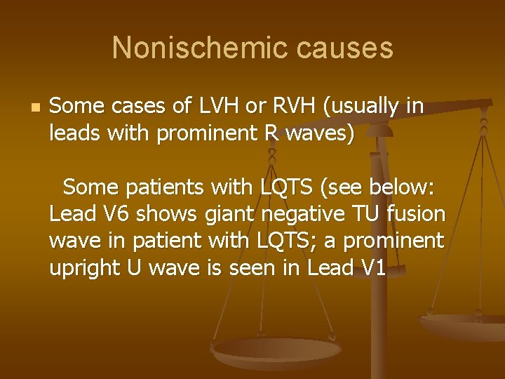 Nonischemic causes n Some cases of LVH or RVH (usually in leads with prominent