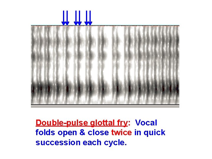 Double-pulse glottal fry: Vocal folds open & close twice in quick succession each cycle.