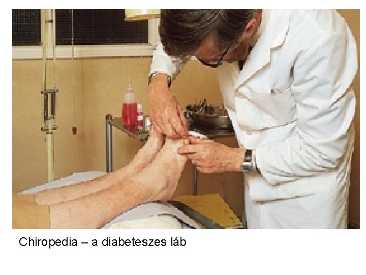 Chiropedia – a diabeteszes láb 