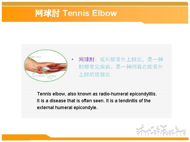 网球肘 Tennis Elbow • 网球肘：或叫肱骨外上髁炎，是一种 肘部常见疾病。是一种附着在肱骨外 上髁的肌腱炎 Tennis elbow, also known as radio-humeral epicondylitis.