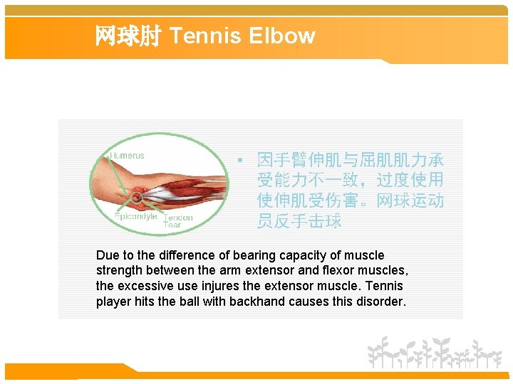 网球肘 Tennis Elbow • 因手臂伸肌与屈肌肌力承 受能力不一致，过度使用 使伸肌受伤害。网球运动 员反手击球 Due to the difference of bearing