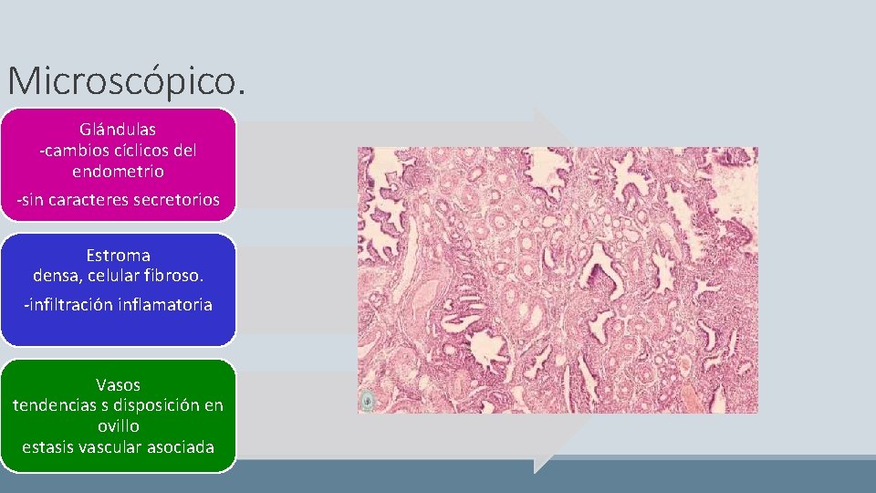 Microscópico. Glándulas -cambios cíclicos del endometrio -sin caracteres secretorios Estroma densa, celular fibroso. -infiltración