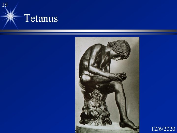 19 Tetanus 12/6/2020 