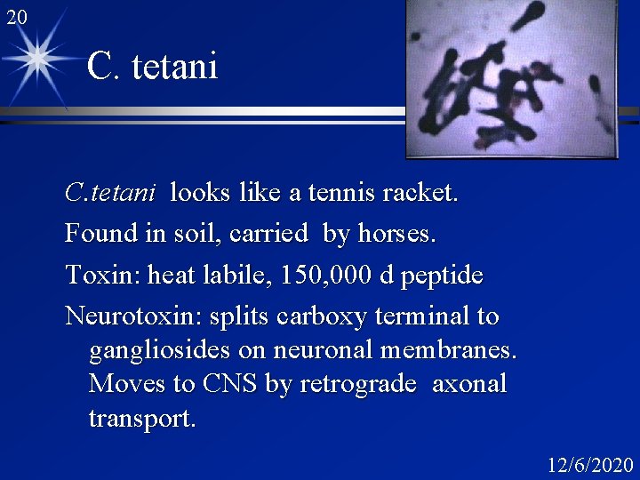 20 C. tetani looks like a tennis racket. Found in soil, carried by horses.