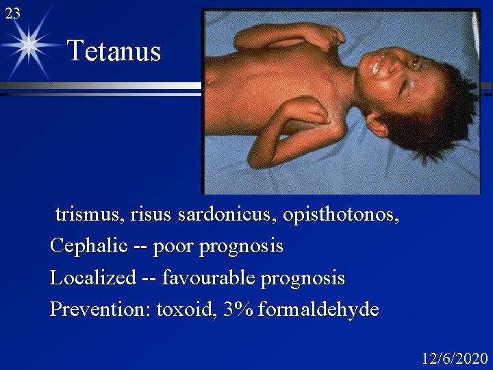 23 Tetanus trismus, risus sardonicus, opisthotonos, Cephalic -- poor prognosis Localized -- favourable prognosis