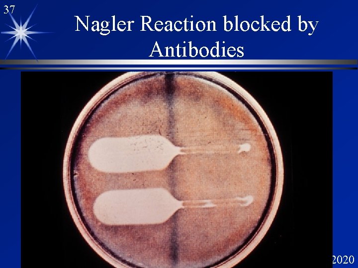 37 Nagler Reaction blocked by Antibodies 12/6/2020 