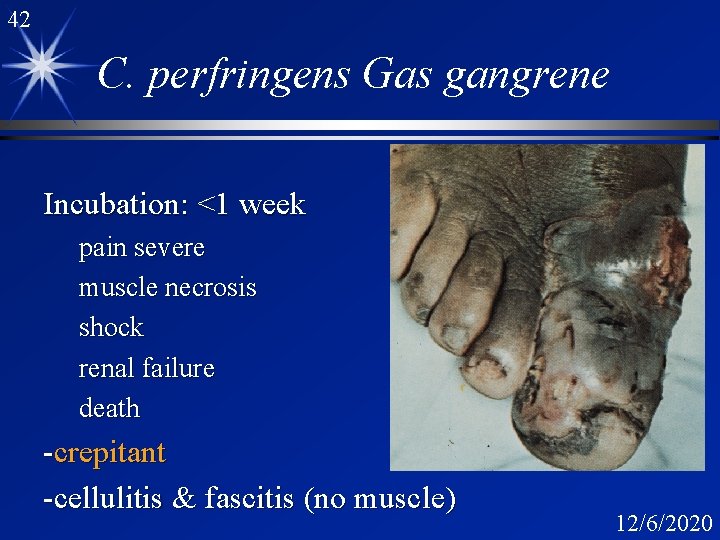 42 C. perfringens Gas gangrene Incubation: <1 week pain severe muscle necrosis shock renal