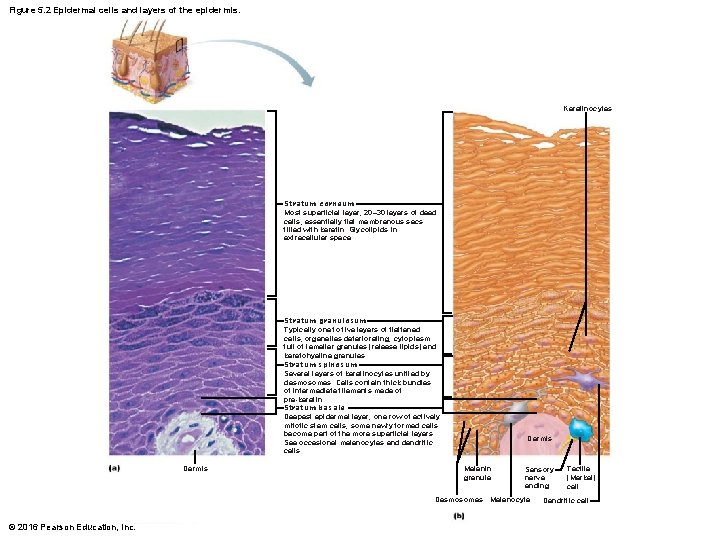 Figure 5. 2 Epidermal cells and layers of the epidermis. Keratinocytes Stratum corneum Most