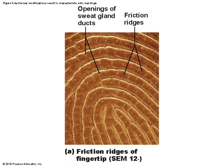 Figure 5. 4 a Dermal modifications result in characteristic skin markings. Openings of sweat