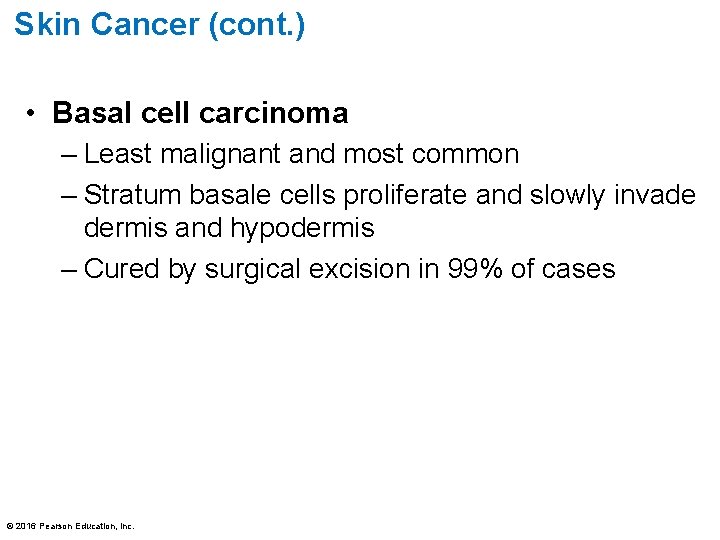 Skin Cancer (cont. ) • Basal cell carcinoma – Least malignant and most common