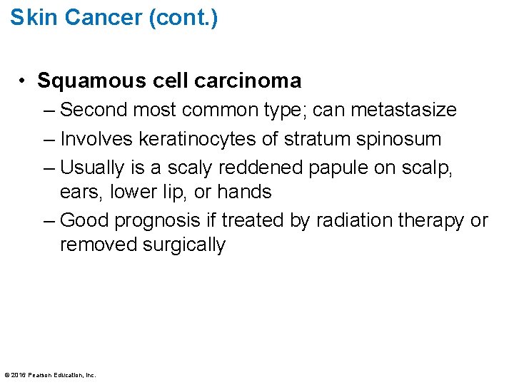 Skin Cancer (cont. ) • Squamous cell carcinoma – Second most common type; can