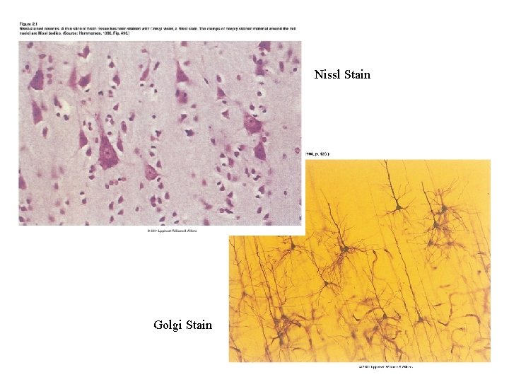 Nissl Stain Golgi Stain 