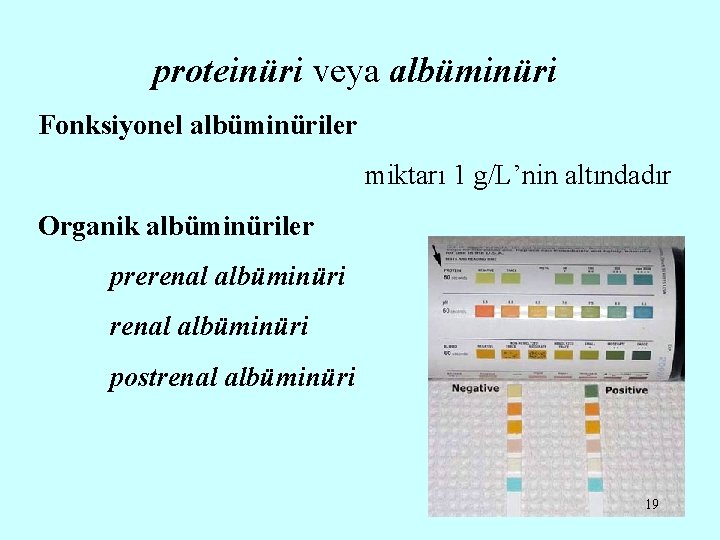 proteinüri veya albüminüri Fonksiyonel albüminüriler miktarı 1 g/L’nin altındadır Organik albüminüriler prerenal albüminüri postrenal