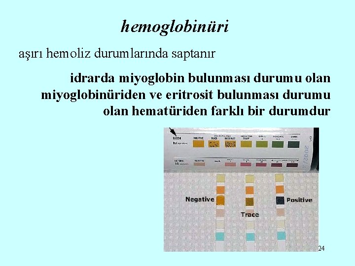 hemoglobinüri aşırı hemoliz durumlarında saptanır idrarda miyoglobin bulunması durumu olan miyoglobinüriden ve eritrosit bulunması