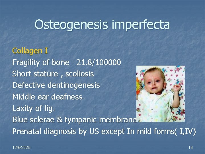 Osteogenesis imperfecta Collagen I Fragility of bone 21. 8/100000 Short stature , scoliosis Defective