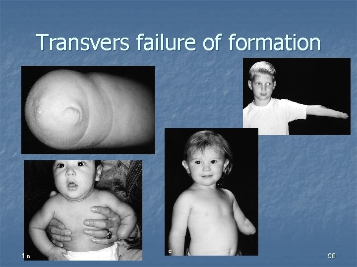 Transvers failure of formation 12/6/2020 50 