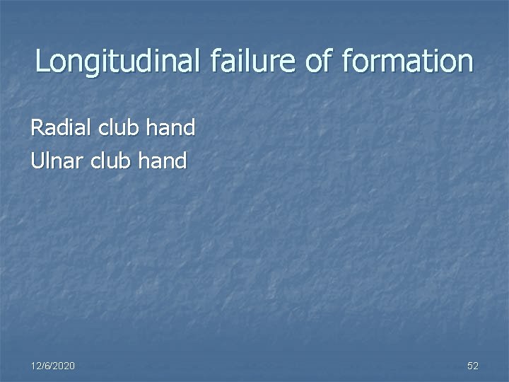 Longitudinal failure of formation Radial club hand Ulnar club hand 12/6/2020 52 