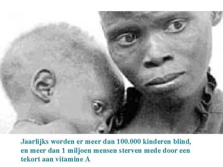 Jaarlijks worden er meer dan 100. 000 kinderen blind, en meer dan 1 miljoen