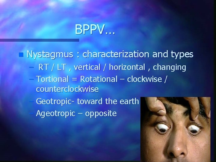 BPPV… n Nystagmus : characterization and types – RT / LT , vertical /