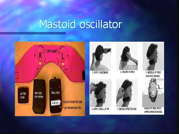 Mastoid oscillator 