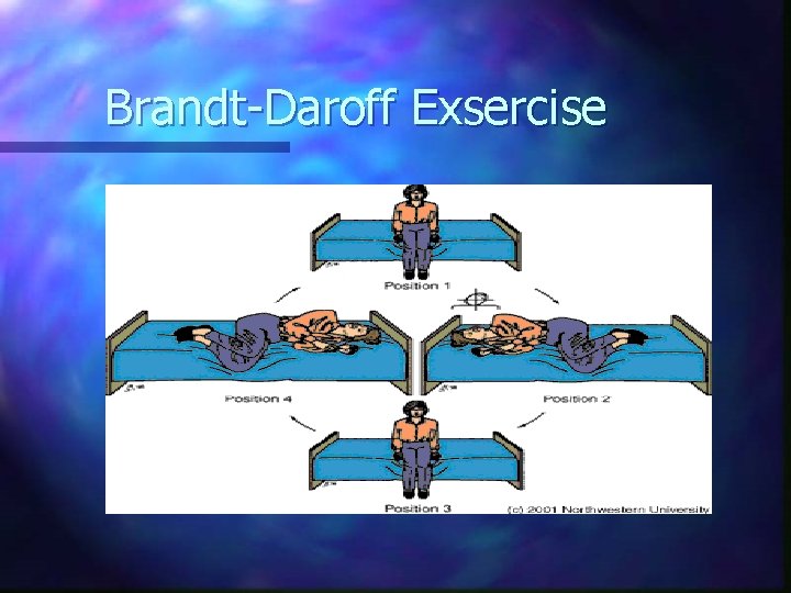 Brandt-Daroff Exsercise 