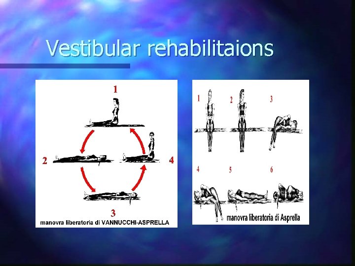 Vestibular rehabilitaions 