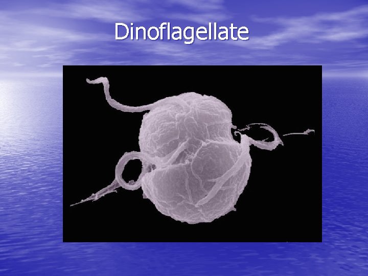 Dinoflagellate 