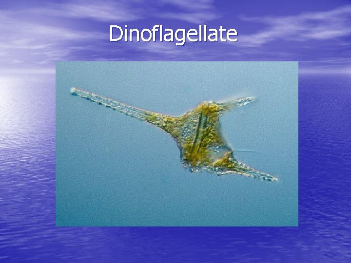 Dinoflagellate 