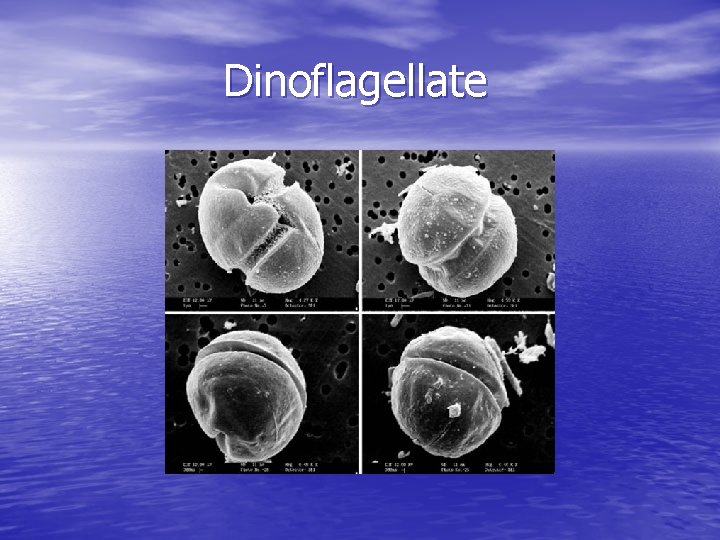 Dinoflagellate 
