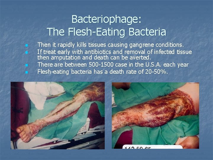 Bacteriophage: The Flesh-Eating Bacteria n n Then it rapidly kills tissues causing gangrene conditions.