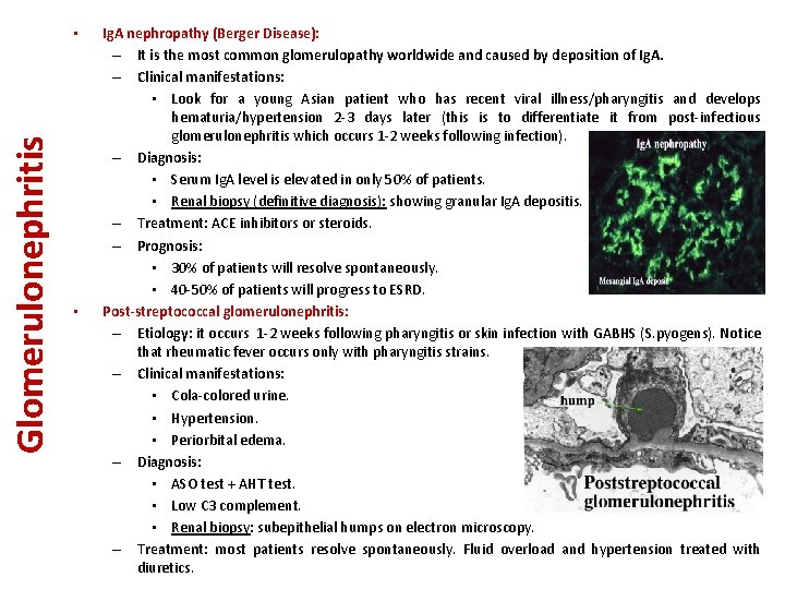 Glomerulonephritis • • Ig. A nephropathy (Berger Disease): – It is the most common