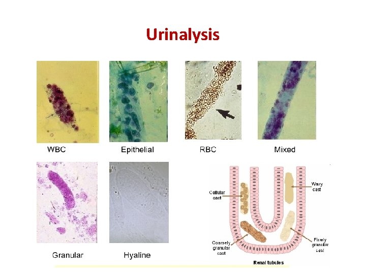 Urinalysis 