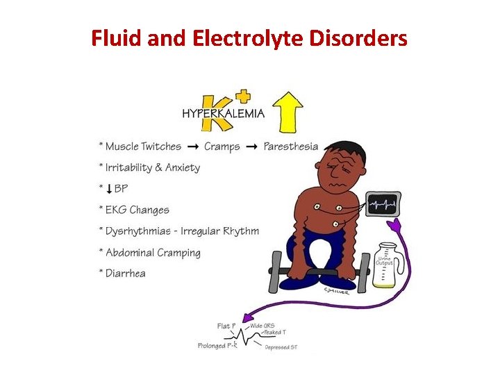 Fluid and Electrolyte Disorders 