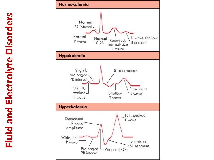 Fluid and Electrolyte Disorders 