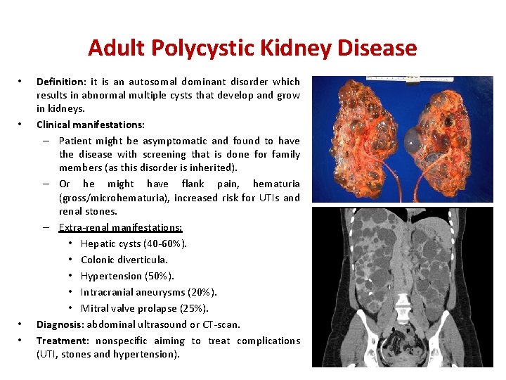 Adult Polycystic Kidney Disease • • Definition: it is an autosomal dominant disorder which